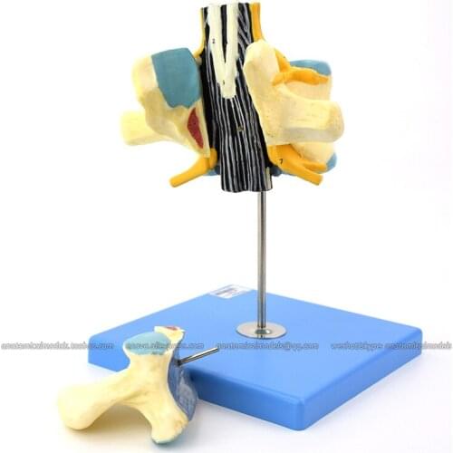 CMAM/12395-1 Lumbar with Spinal Cord, Cauda Equina Enlarged Model, Medical Backbone Anatomical Human Model