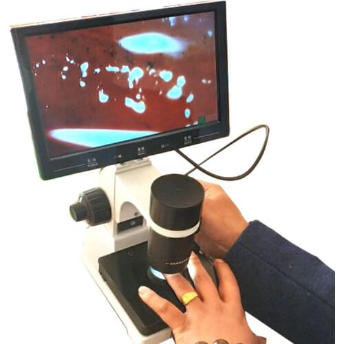 Zoom Digital Microscope Blood Microcirculation Instrument LCD Display Optional Nailfold Capillary Microcirculation Detector