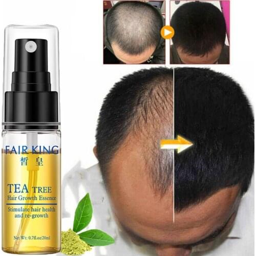 Hair Care Hair Growth Essential Oil Spray Effective Prevent Hair Loss Treatment Products Fast Thick Regrowth Hair Repair Natural