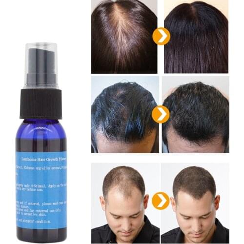 Y&W&F Fast Growth 30ml Yuda Pilatory Spray Anti Baldness Hair Care Hair Loss Treatment Beard Oil Growing Facial Hair TSLM2