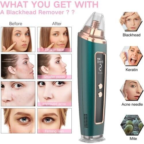 Coflag Vacuum Pore Cleaners