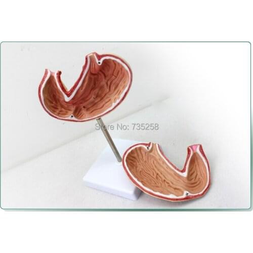 Gastric Anatomy Model,Digestive System Anatomical Model