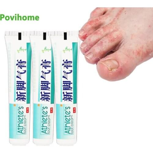 1/3Pcs Athletes Foot Treatment Cream Remove Odor Beriberi Antibacterial Ointment Foot Anti Itching Peeling Health Care Plaster