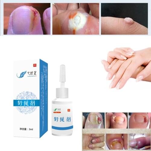 Relief Pain Paronychia Ingrown toe nails hand and Foot Toenails Manicure Set Painless Cut Nail Relief Liquid