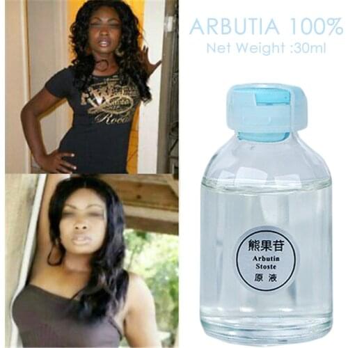 Arbutin Skin Brightening Essence Liquid For Removing Chloasma Lightening Brightening Serum Kojic Acid Bleaching Cream Skin Care