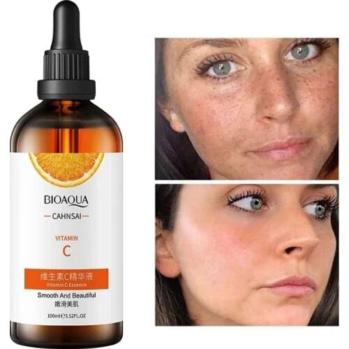 Vitamin C Face Serum Moisturizing Whitening Repair Lighten Spots Brighten Skin Tone Gentle Oil Control Facial Essence