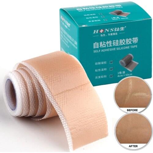 4x150cm Silicone Scar Band Efficient Surgery Removal Gel Sheet Therapy Patch Acne Trauma Burn Cover Skin Repair Scar Treatment