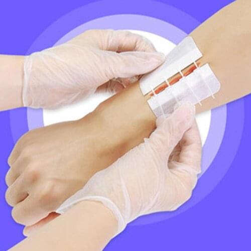Portable 4 Zipper Band-Aid Zipper Tie Wound Closure Patch Hemostatic Patch Wound Fast Suture Health Care