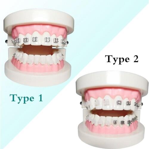 1 Piece Dental Orthodontic Teeth Model Metal/Ceramic Brackets Contrast with Buccal Tubes