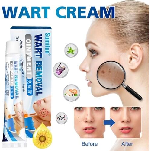 Skin Tag Remover Cream Safe & Effective Wart Callus Mole Milia Treatment Quick Removal Skin Care for All Skins
