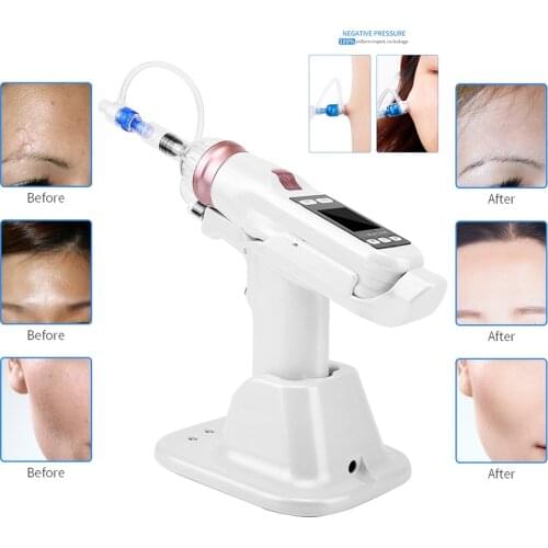 Hydrolifting Gun Korea Mesotherapy EZ Negative Pressure Meso gun Mesotherapy Hydrolifting Water Injector Microcrystal Injection