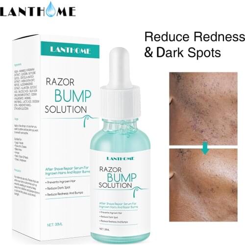 Razor Bump Stopper Ingrown Hair treatment After Shave Reduce Dark Spots Redness Razor Burns Solution for Men Women