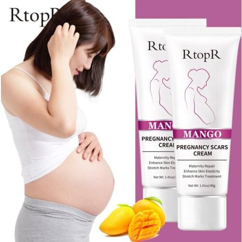 Mango Stretch Marks Repair Cream Remove Pregnancy Scars Acne Treatment Maternity Anti-Aging Anti Winkles Firming Body Creams