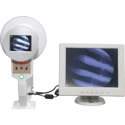 High Quality Fluoroscopy Medical Mini X-Ray Machine Portable Fluoroscopy For Hospital