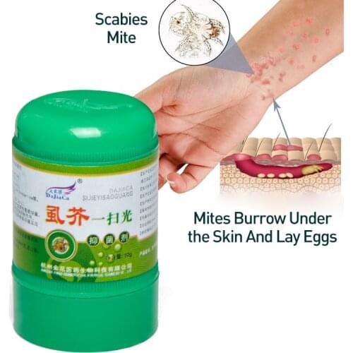 1pcs Herbal Scabies Cream Pubic Body Lice Mite Underarm Intimate Dermatitis Psoriasis Treatment Antibacterial Ointment Skin Care