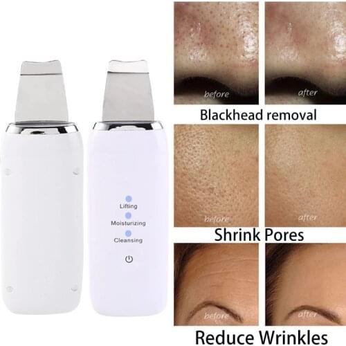 Skin Scrubber Ultrasonic Deep Face Cleaning Machine Remove Dirt Blackhead Reduce Wrinkles and spots Facial Scrubber Peeling