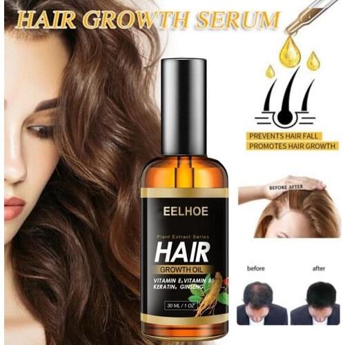 Hair Growth Essence Essential Oil Hair Growth Oil Fast Growing Hair Oil Hair Beauty Loss Care Hair Care Thicker Anti Hair Loss
