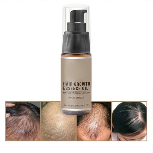 20ml Hair Growth Liquid Fast Grow Hair Treatment Preventing Hair Loss Liquid Hair Care