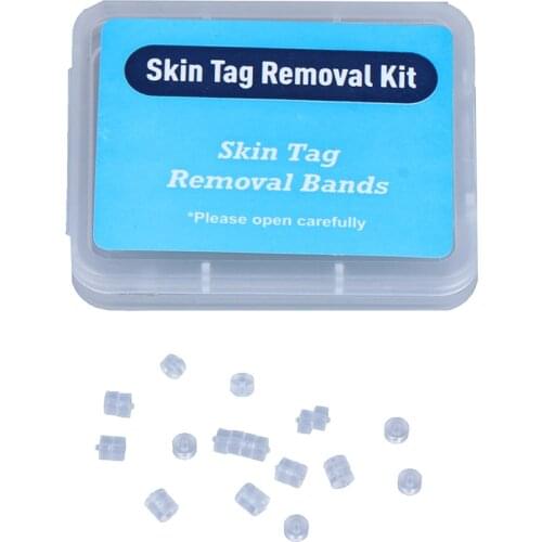 30Pcs/box Non Toxic Face Care Mole Wart Tool For Small To Medium Blue Skin Tag Removal Kit With Cleansing Swabs Home Use Adult