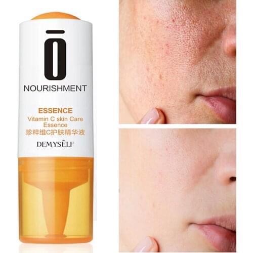 Сыворотки для лица Yoxier China At AliExpress