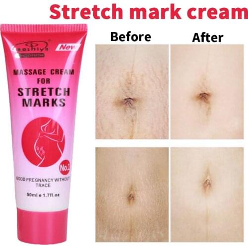 Remove Scars Relieve Acne Body Scars Skin Care Repair Acne Scar Massage Cream Firming Abdomen Reducing Stretch Mark Cream 50g