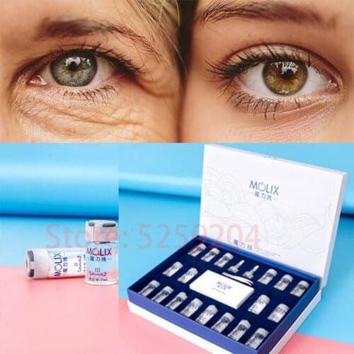 Hot Sale Radar thread carve Absorbable Collagen Based Lifting Thread Protein thread Carving for anti wrinkle serum Facial skin