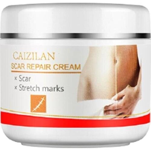 Remove Pregnancy Scars Acne Cream Stretch Mark Treatment Skin Care Treatment Cream For Stretch Mark Removal Maternity Slackline