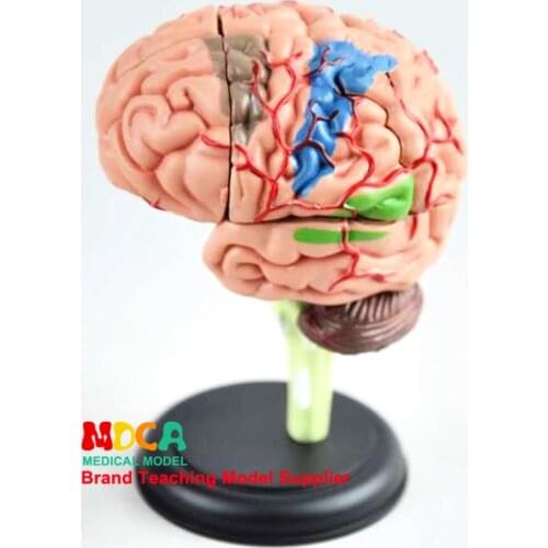 Educational Toys Human Organs 4D Brain Assembly Model Medical Teaching MDN001