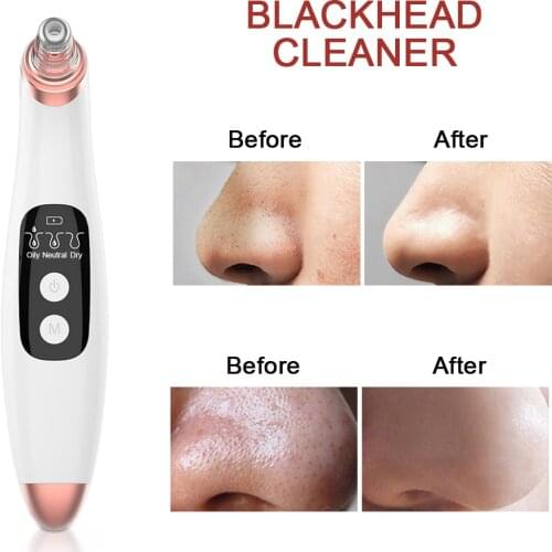 USB Vacuum Suction Blackhead Remover Nose Facial Pore Cleaner Spot Acne Black Head Pimple Removal Beauty Face Skin Care Tools