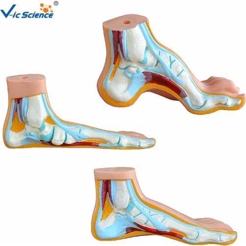 Complete Set Foot Anatomy Model Normal Flat Arched Foot Model