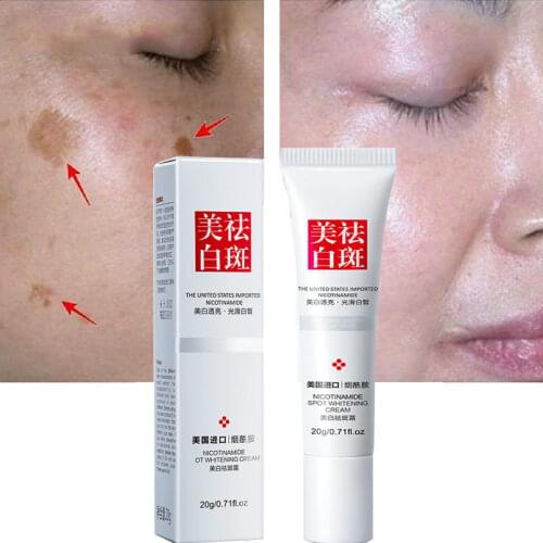 Whitening Face Cream Retinol Freckles Cream Age Spots Skin Whitening Strong Effect Dark Spots Melasma Lightening Lip Face Cream