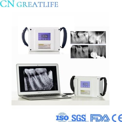 Good Price LCD Touch Screen Wireless Imaging System Digital Machine Unit Portable Dental X Ray