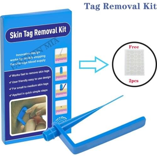 Home Use Micro Mole Wart Remover Skin Tag Removal Kit With Cleansing Swab Tool and Free Mole Stickers for Tag and Moles Removal