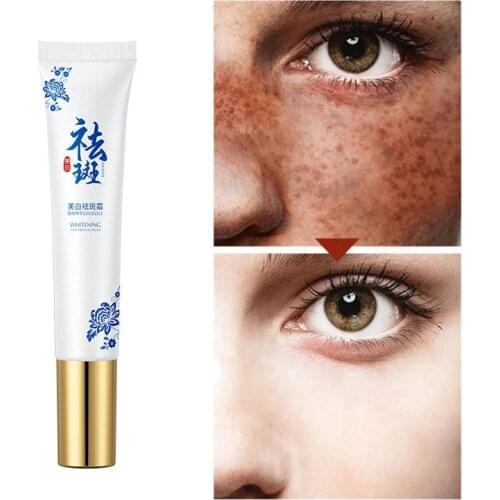 Effective Whitening Freckle Cream Remove Melasma Acne Spot Pigment Melanin Dark Spots Pigmentation Moisturizing Skin Care