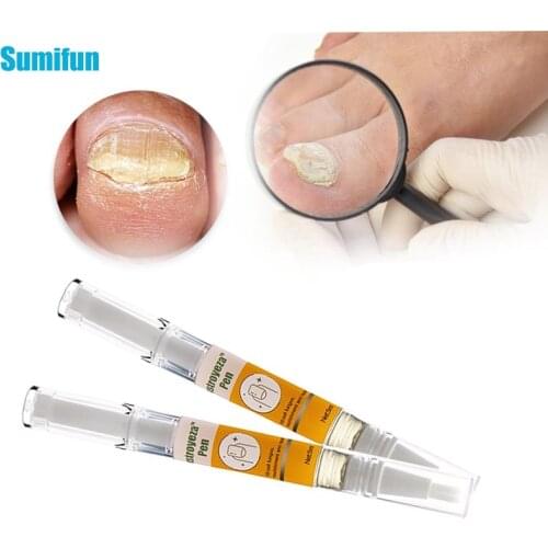 5Ml Nail Care Gel Nail Fungal Treatment Anti Infection Paronychia Onychomycosis Foot Whitening Toe Nail Fungus Removal Repair