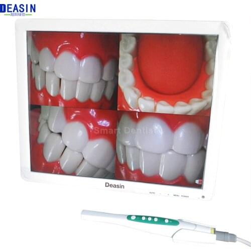 High Quality 5.0 mega pixels 17inch LCD monitor with usb intra oral camera all in one machine Dental endoscope