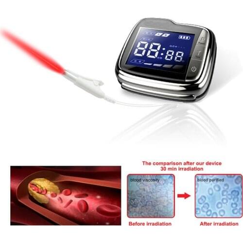 650nm Diode Low Level Laser Therapy Watch LLLT for Diabetes Rhinitis Cholesterol Hypertension Physiotherapy Treatment Healthcare