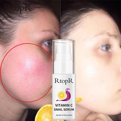 RTOPR Vitamin C Snail Facial Serum Whitening Anti Wrinkle Reparing Rejuvenation Moisturizing Nourishing Face Skin Care
