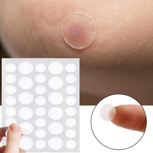 36Pcs/Set Acne Patch Waterproof Invisible Ultra Thin Pimple Removing Facial Patches Quickly Fix Skin for Beauty Makeup Tools