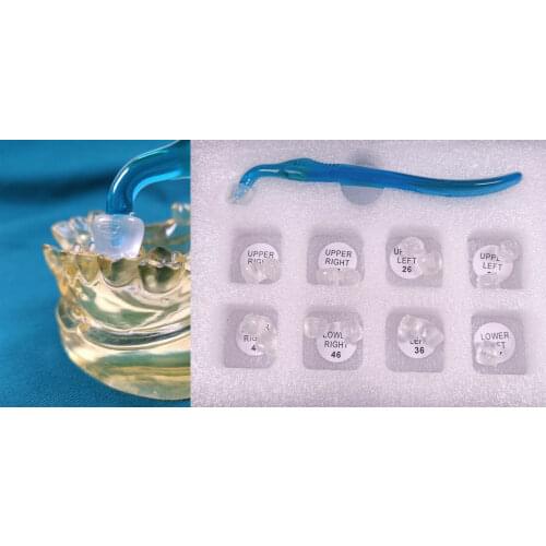 1Kit Dental Restoration Filling Tools Dental Posterior Teeth Aesthetic Printing