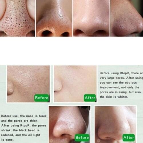 Natural Organic Herbal Essential Black Bamboo Oil Soap Handmade Deep Skin Cleansing Face Acne Whitening Soap Care Remove S6R5