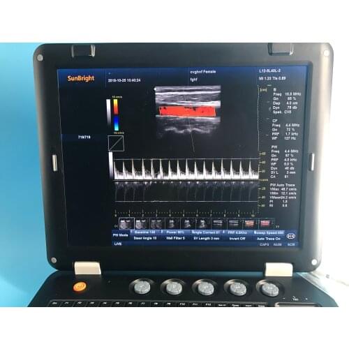 Economical manufacturer 3D echocardiography machine color doppler ultrasound
