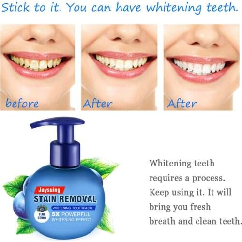 Viaty toothpaste Baking soda remove stain whitening toothpaste fight gums toothpaste New Zealand toothpaste fruit flavor d40