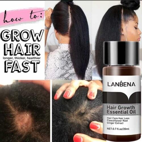 New Powerful Hair Growth Serum Preventing Hair Loss Liquid Anti-Alopecia Care Faster Growing Dense Ginger hair Oil 20ml Unisex