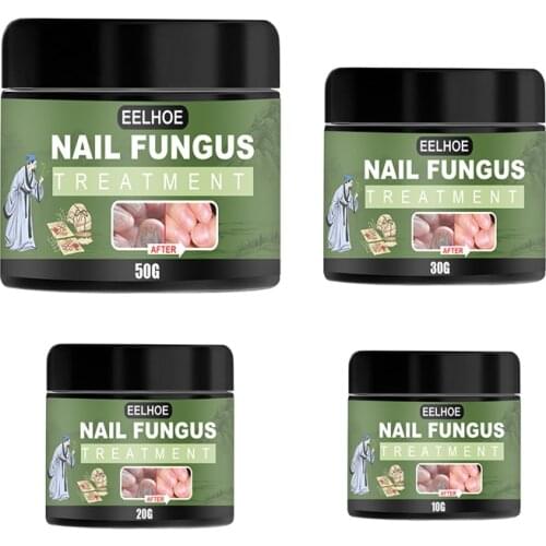 10g/20g/30g/50g Onychomycosis Liquid Hand And Foot Cream Care And Repair Antibacterial Thickening Nail Treatments TSLM2