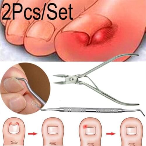 New 2Pcs/1Set Ingrown Toe Nail Correction Nippers Clipper Cutters Dead Skin Dirt Remover+Paronychia Podiatry Pedicure Care Tool