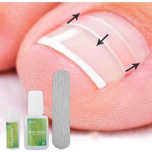 12pcs /bottle Ingrown Toenail Correction Tool Set Ingrown Toe Nail Pedicure Elastic Patch Straightening Clip Brace with Glue