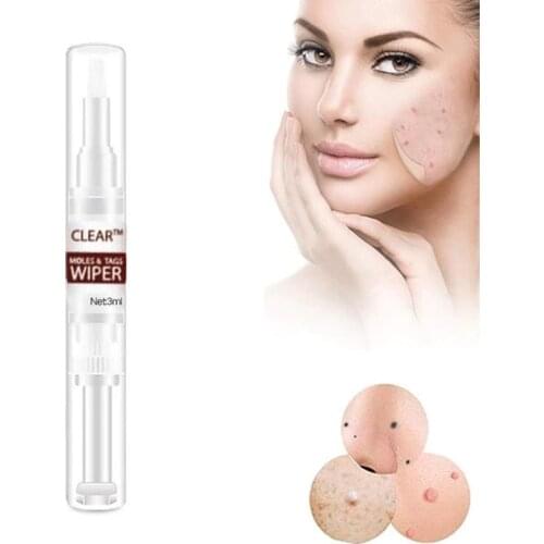 3ml Clear Moles & Tag Wiper Wipeoff Tags & Moles Remover Liquid Wart Removal Pen Genital Wart Treatment