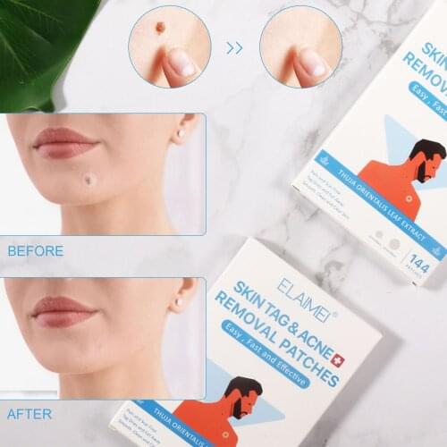 144pcs Invisible Skin Tag Remover Patch Hydrocolloid Acne Invisible Pimple Master Patch Patch Ingredient Skin Label Removal
