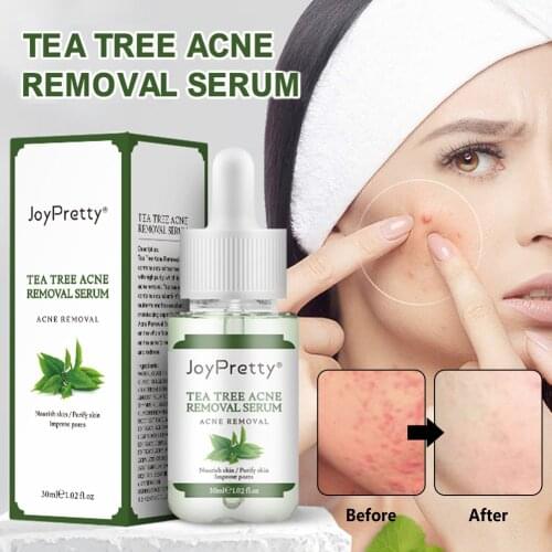 Восстанавливающие сыворотки для лица Aichun Beauty China At AliExpress